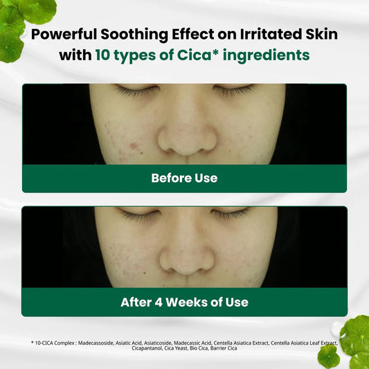 Dr.G R.E.D Blemish Clear Soothing Cream 70ml