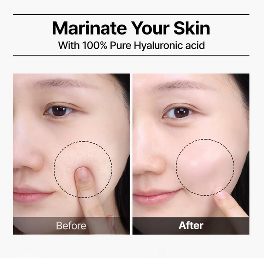 Before-and-after skincare comparison showing a woman's cheek with text reading 'Marinate Your Skin With 100% Pure Hyaluronic acid'. The left panel labeled 'Before' shows a textured cheek area circled in dashed lines, and the right panel labeled 'After' shows a smoother, plumper cheek area.