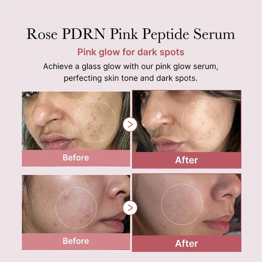 medicube PDRN Pink Peptide Serum 30ml medicube