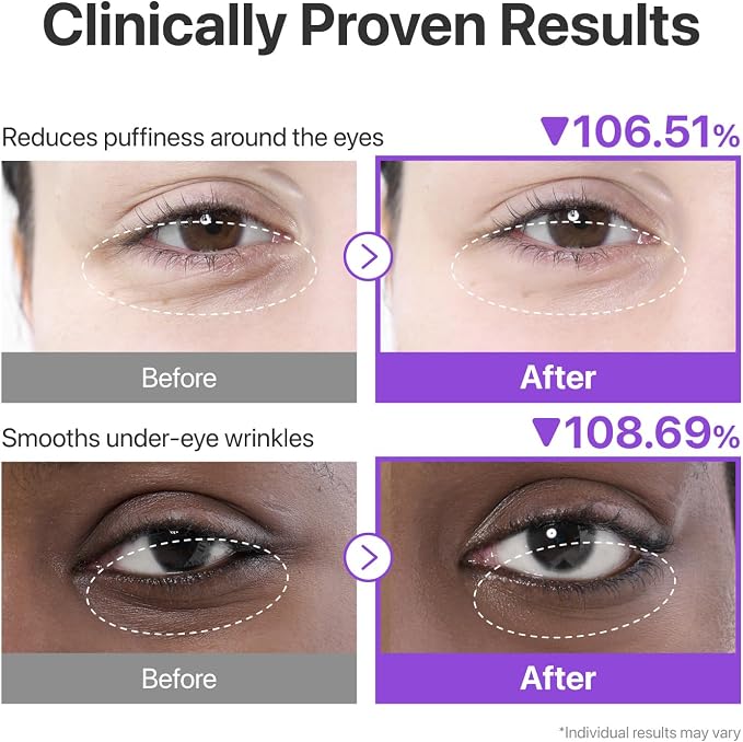 numbuzin No.9 NAD+ Collagen Under Eye Patches