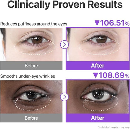 numbuzin No.9 NAD+ Collagen Under Eye Patches