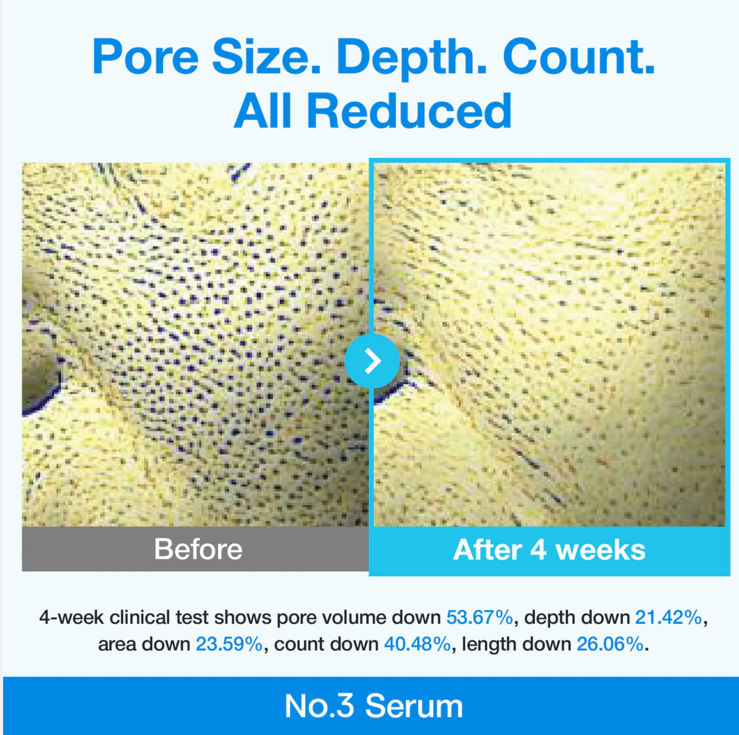 numbuzin No.3 Blue Bio-Retinol Pore Refining Serum 30ml