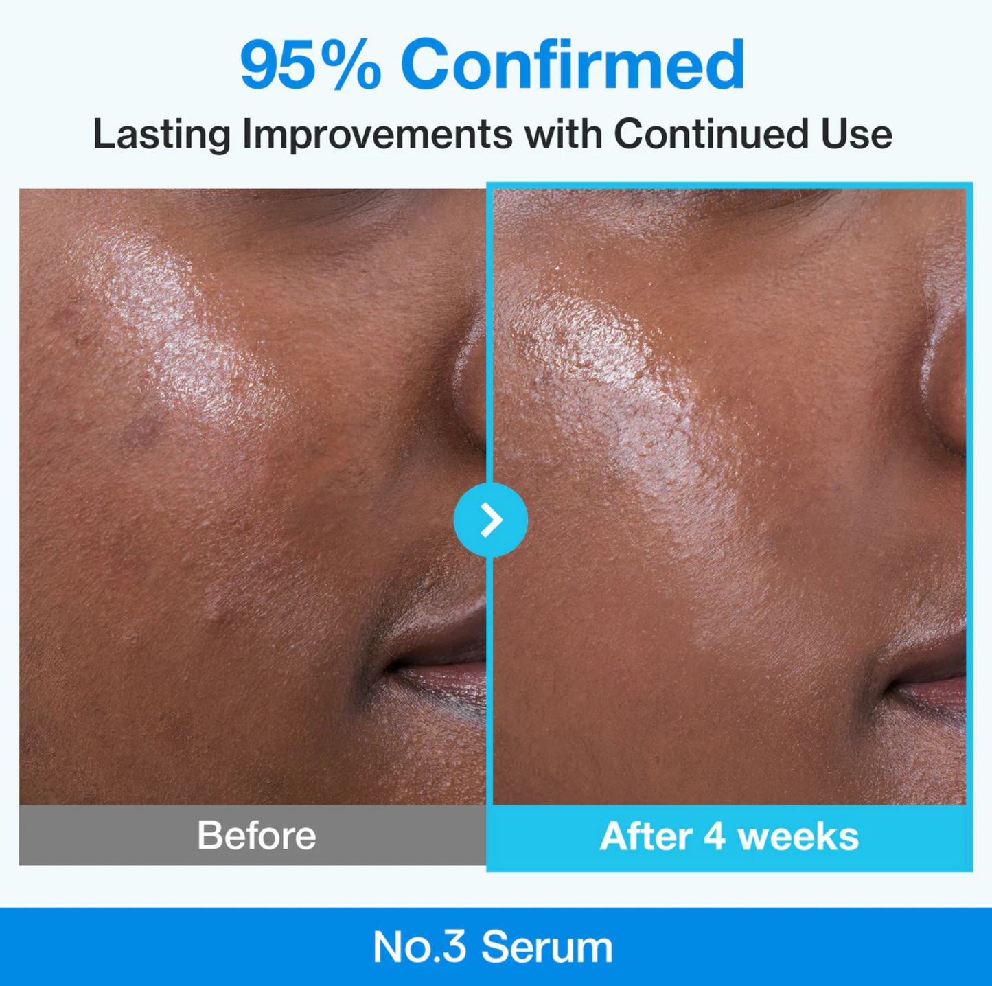 numbuzin No.3 Blue Bio-Retinol Pore Refining Serum 30ml