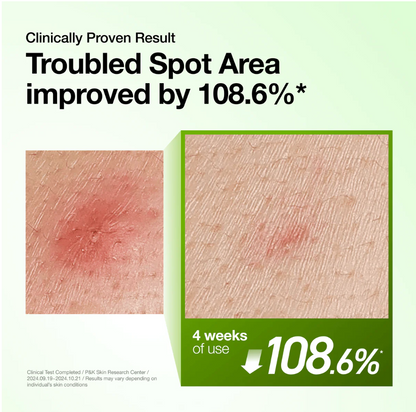 Sérum Apaisant Anti-Rougeurs à l'Acide Azélaïque 10 et à l'Acide Hyaluronique Anua 30 ml