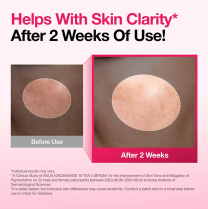 Sérum Anua Niacinamide 10% + TXA 4%