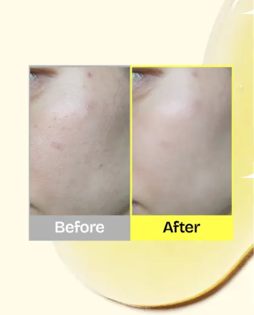 Orien Propolis Niacinamide Serum 30ml