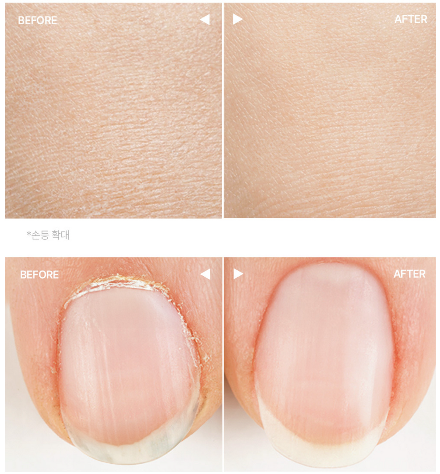 Before-and-after comparison of skin and fingernail appearance, showing a close-up of textured skin labeled BEFORE and smooth skin labeled AFTER,3. hetras Perfume Essence Hand Lotion 515ml - Flower Shop
