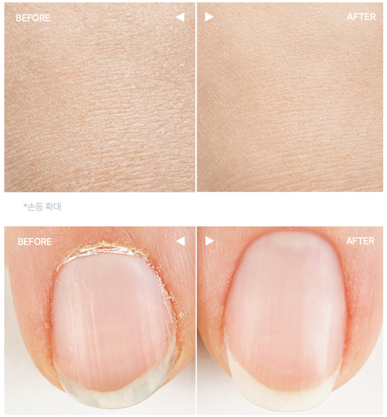 Before-and-after comparison of skin and fingernail appearance, showing a close-up of textured skin labeled BEFORE and smooth skin labeled AFTER,3. hetras Perfume Essence Hand Lotion 515ml - Flower Shop
