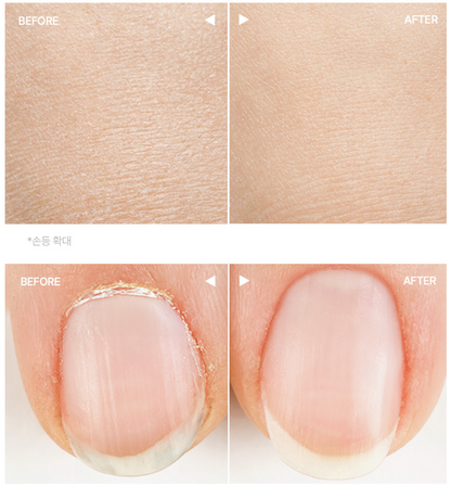 Before-and-after comparison of skin and fingernail appearance, showing a close-up of textured skin labeled BEFORE and smooth skin labeled AFTER,3. hetras Perfume Essence Hand Lotion 515ml - Flower Shop
