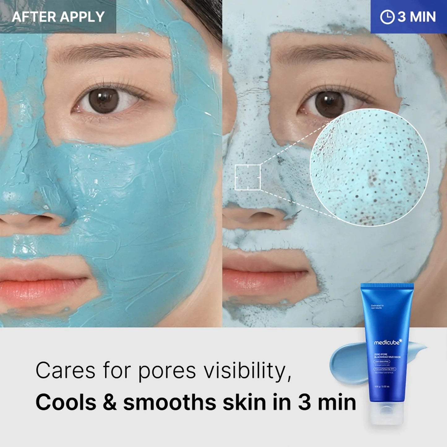 medicube Zero Pore Blackhead Mud Mask VGLE Studios