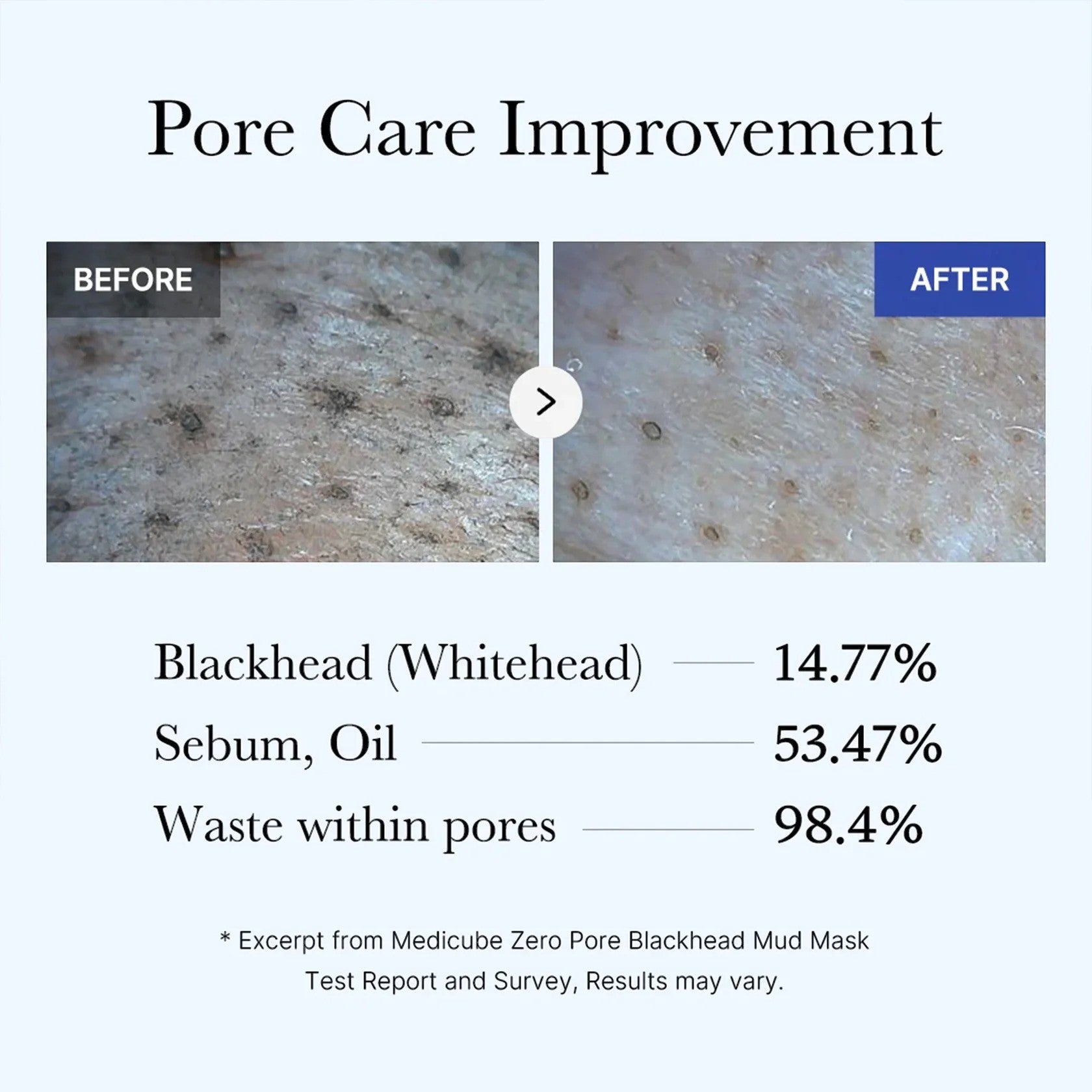 medicube Zero Pore Blackhead Mud Mask VGLE Studios