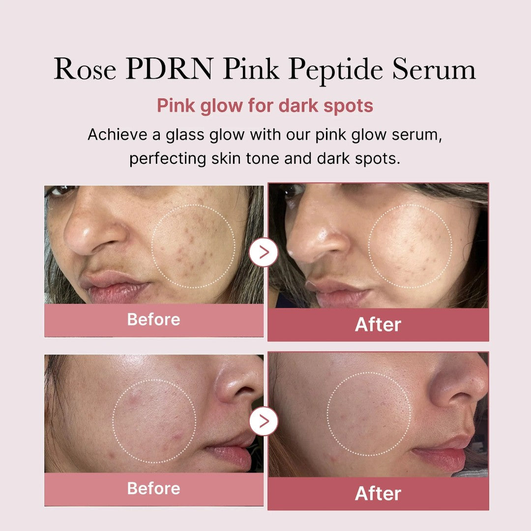 medicube PDRN Pink Peptide Serum 30ml medicube