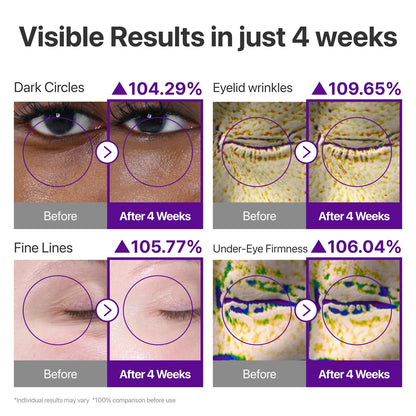 A before-and-after results graphic showing four eye-area cosmetic improvements: dark circles, eyelid wrinkles, fine lines, and under-eye firmness, each with percentage improvements after 4 weeks and close-up skin/eye photos labeled before and after.