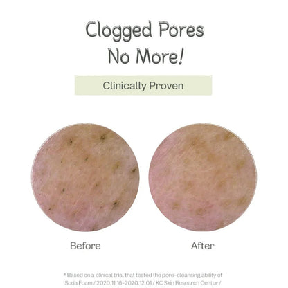 ma:nyo Purifying Cleansing Soda Foam 150ml before and after showing unclogged pores effects.